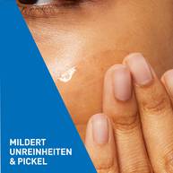 Anti-Unreinheiten Gel fur unreine, zu Akne neigende Haut 40ml