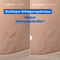 Stretchmark Oil 100ml