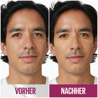 Instant Anti-Age Effekt Loscher Concealer 03 Fair 6,8ml